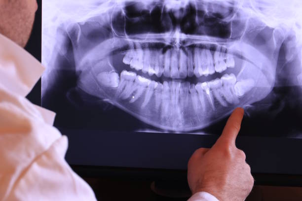 Best Knocked-Out Tooth Emergency  in Paradise Hills, NM
