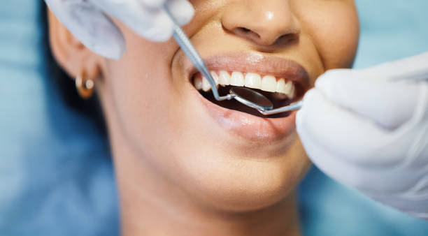 Best Knocked-Out Tooth Emergency  in Paradise Hills, NM
